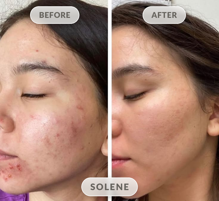 Solene